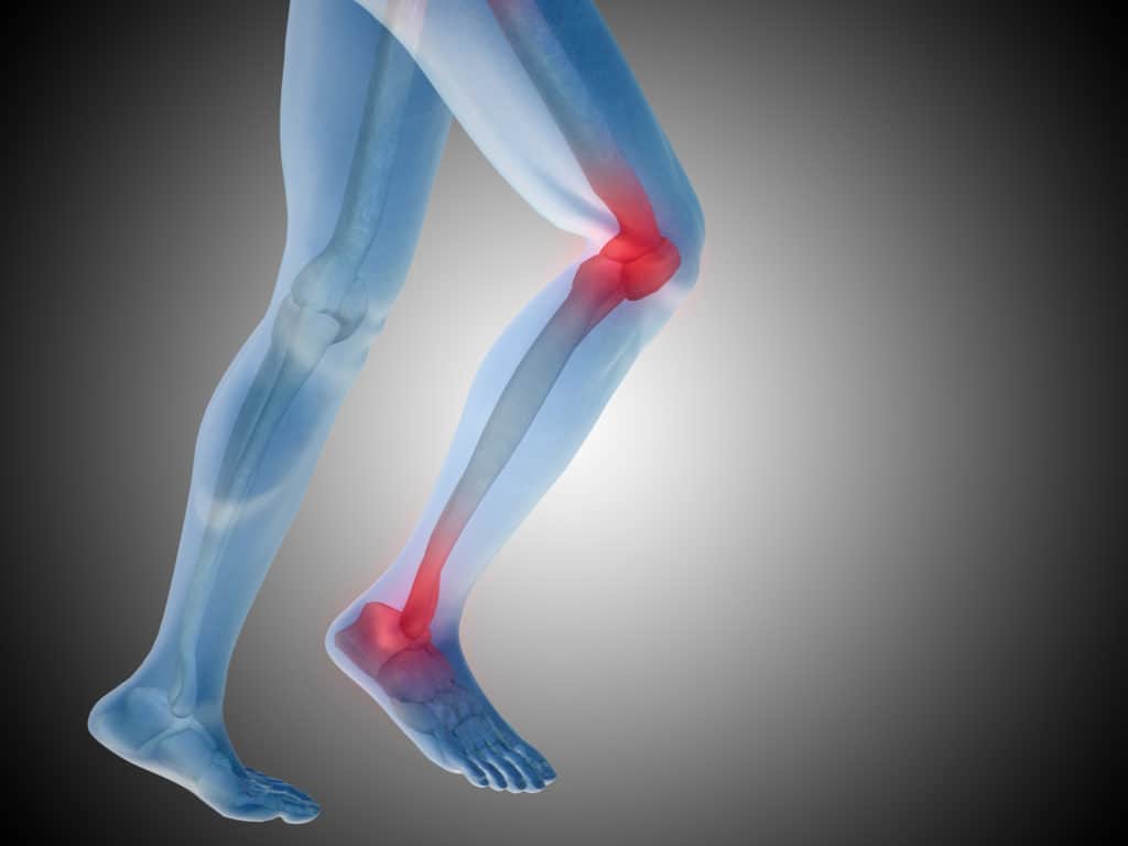How To Recover From An ACL Injury 
