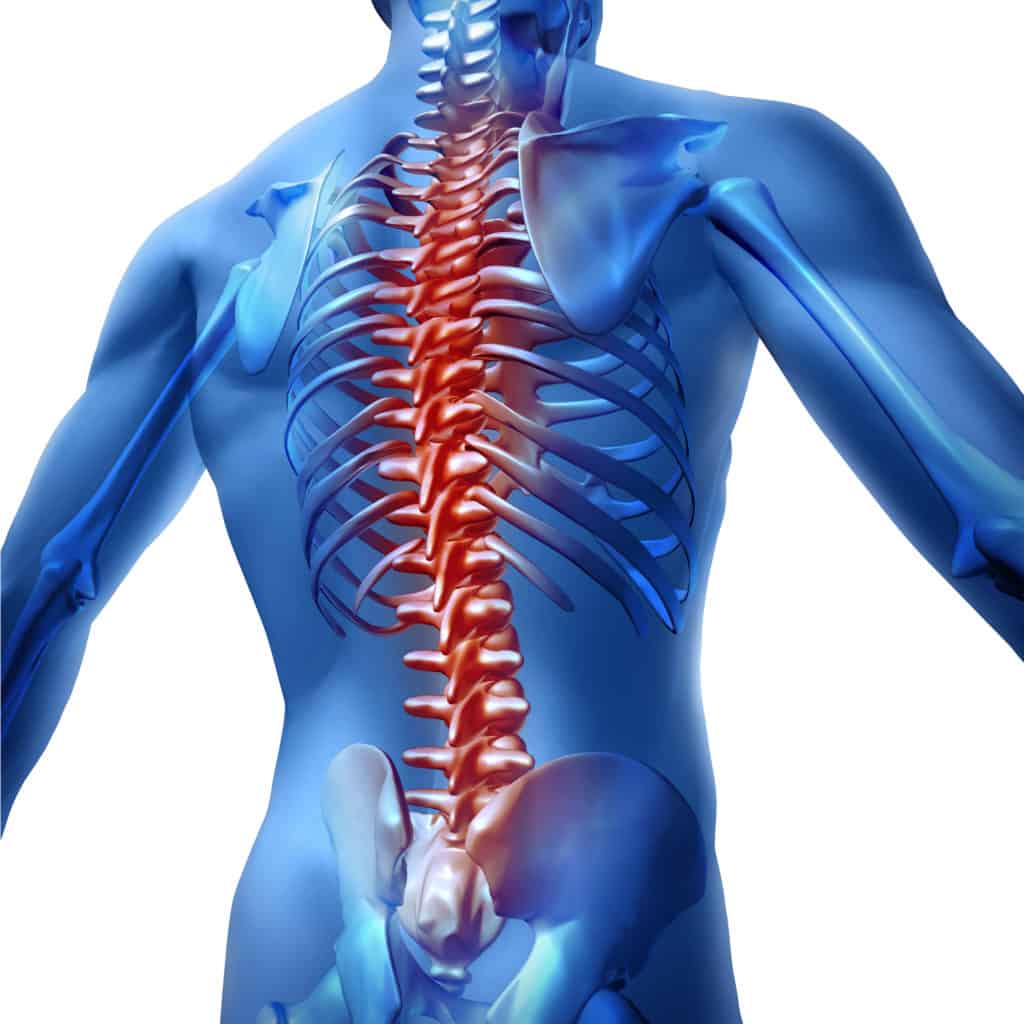 spine pain in people with bad posture