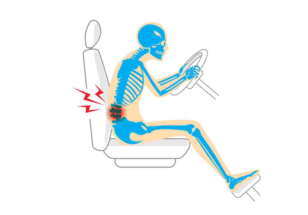 x ray of poor posture while driving causing back pain 