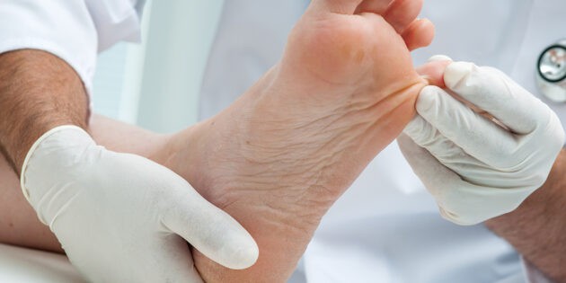neuropathy in feet