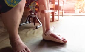 foot split for ankle surgery