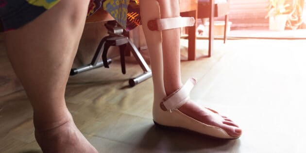 foot split for ankle surgery